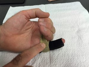 broken finger