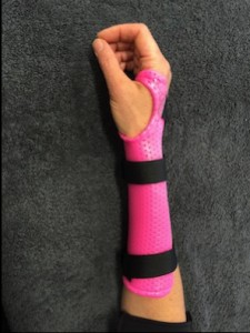 broken wrist splint